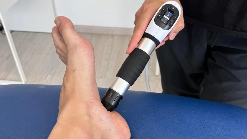 ondas de choque para fasctitis plantar
